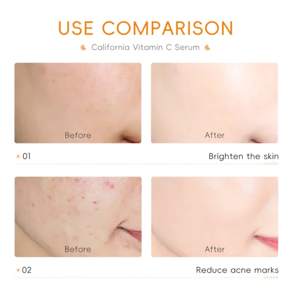 LAIKOU Soro Facial Vitamina C VC Clareador Anti-Aging Freckle Dark Spot Hidratante 17ml - Imagem 4